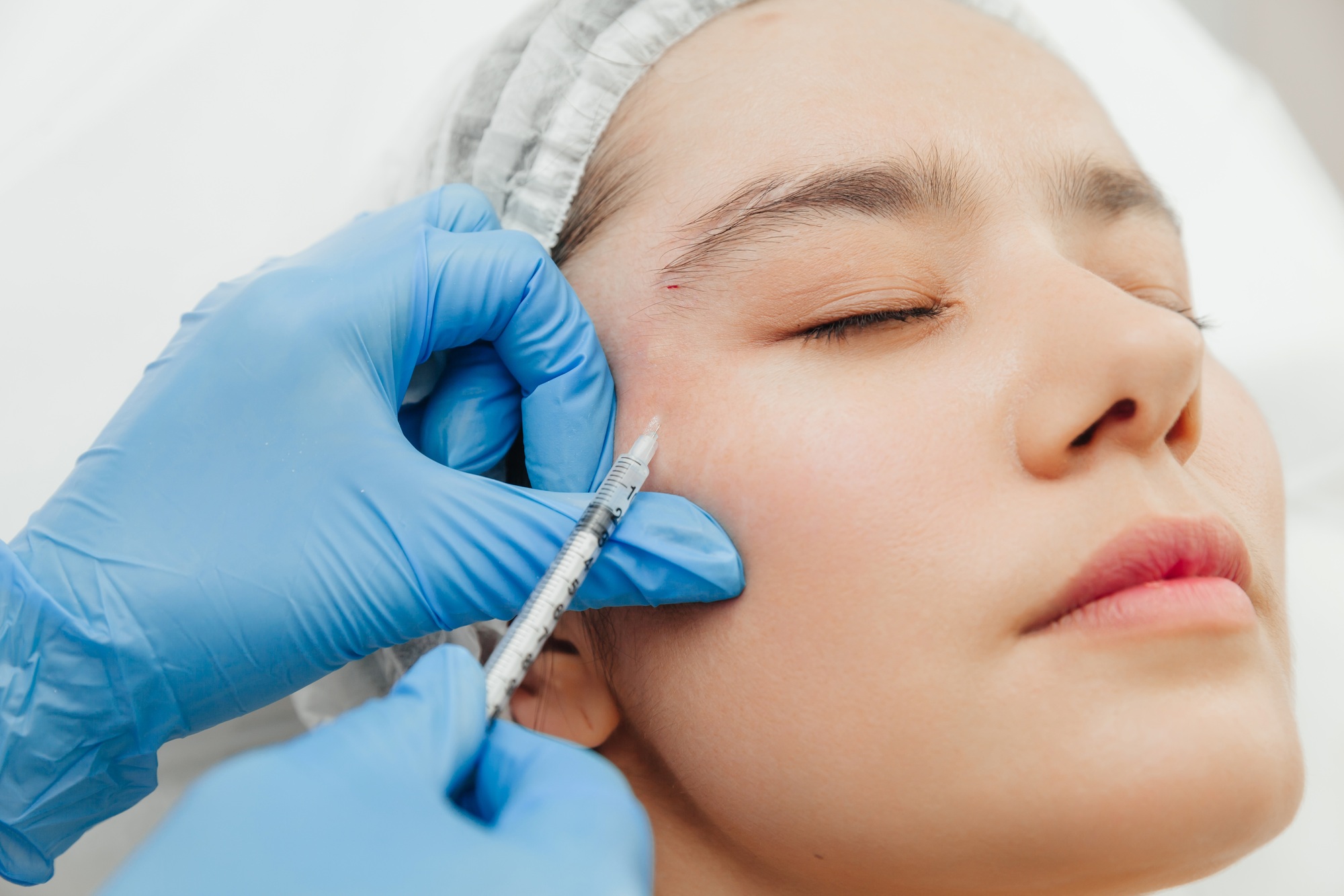 Close-up of the hands of a beautician injecting Botox into a woman's forehead.