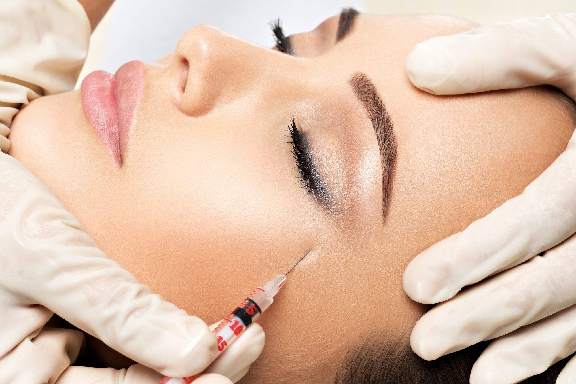 Toxina botulínica (botox) en estética dermatológica Almería